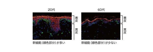 皮膚の幹細胞は歳を重ねるとともに減少する