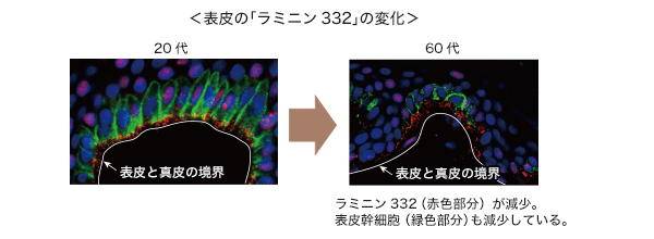 表皮の「ラミニン332」の変化