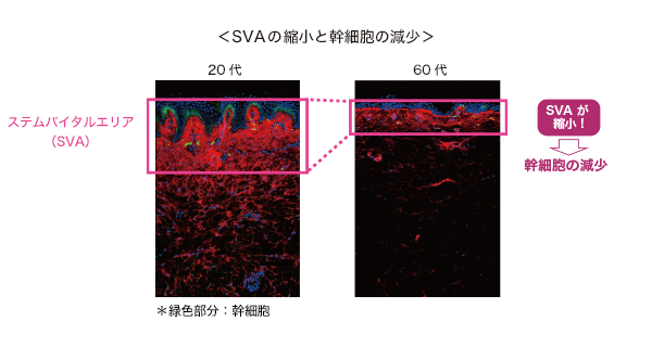SVAの縮小と幹細胞の減少1