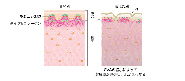 SVAの縮小と幹細胞の減少2