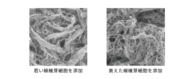 コラーゲン線維の状態