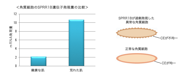 角質細胞のSPRR1B遺伝子発現量の比較、SPRR1Bが過剰発現した 異常な角質細胞、正常な角質細胞