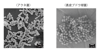 アクネ菌と表皮ブドウ球菌